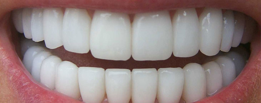 implantes dentales en guadalajara