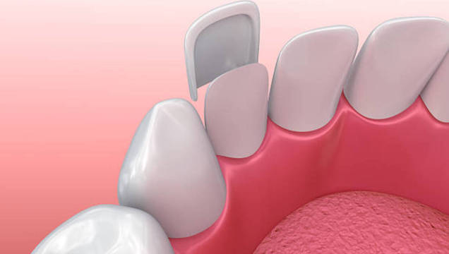 implantes dentales en guadalajara