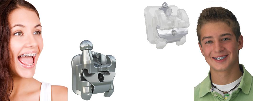 ortodoncia en guadalajara