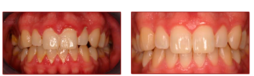 peridoncia en guadalajara