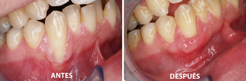 peridoncia en guadalajara